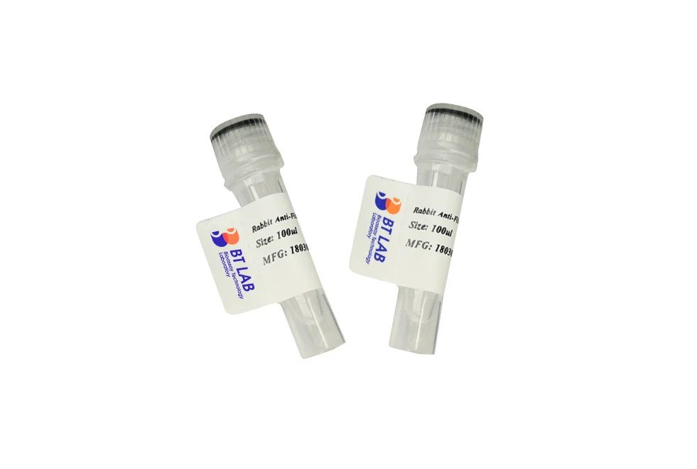 Hepatitis B Surface Antigen adr subtype, CHO Protein